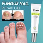 Efroo 20g Nail Repair Gel